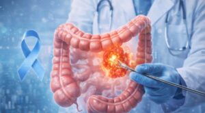 Kolon Kanseri Farkındalık Ayı’nda erken teşhis uyarısı Kolon Kanseri Farkındalık Ayı’nda erken teşhis uyarısı