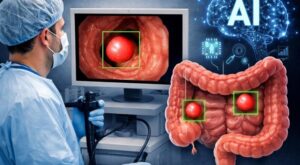 Yapay zeka kolonoskopide polip tespitini artırıyor